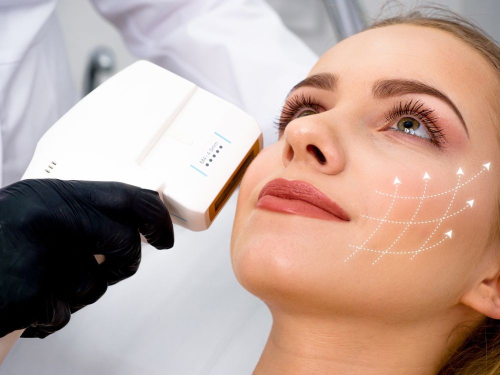 Woman receiving facial treatment with a handheld device, featuring diagram of arrows on cheek.